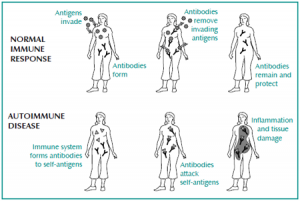 Comparison of normal immune response with autoimmune disease response