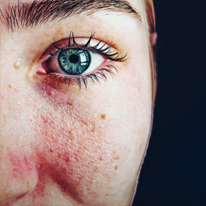 Reading Your Face What Can It Tell You About Hormone Balance reading your face